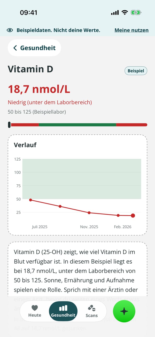 Zyva-Bildschirm für Vitamin D mit Beispieldaten: 18,7 nmol/L, unter dem Laborbereich von 50 bis 125, mit Verlaufsdiagramm und einer einfachen Erklärung.